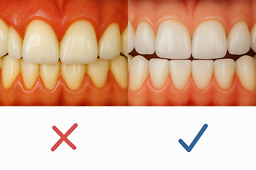 Co znamená nedostatečná hygiena?