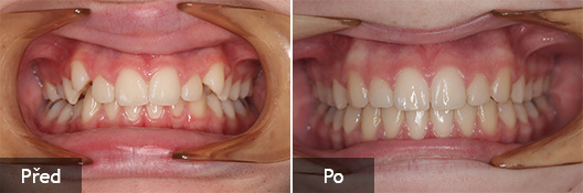 Co znamená nedostatečná hygiena?